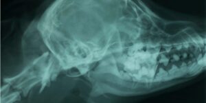 Common Challenges with Dental Radiographic Interpretation and Positioning